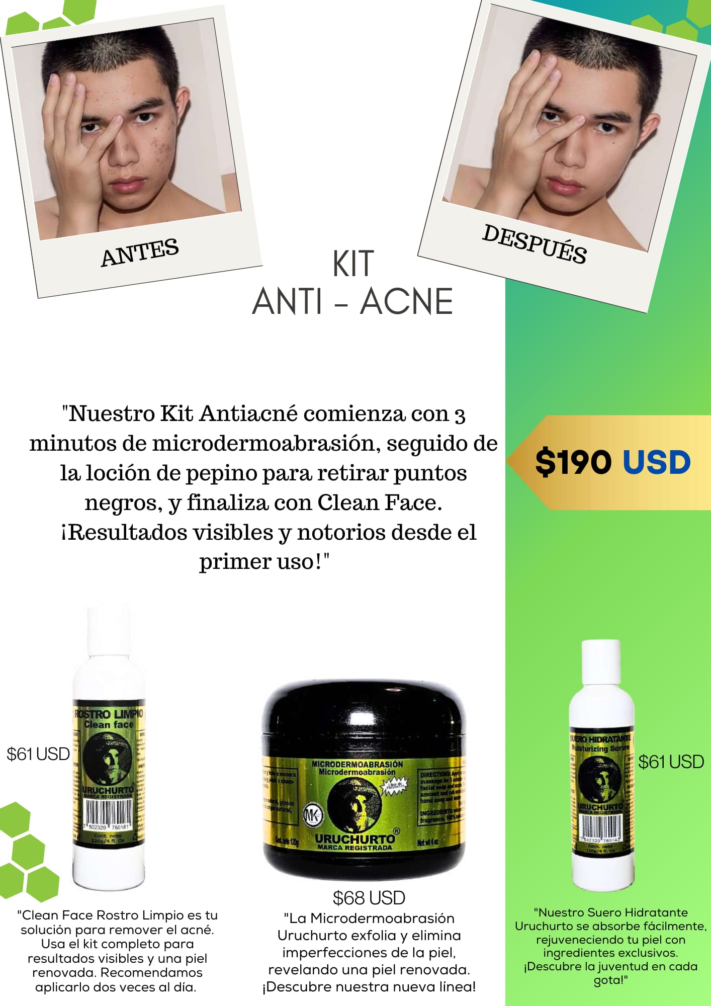 KIT ANT_ACNÉ URUCHURTO