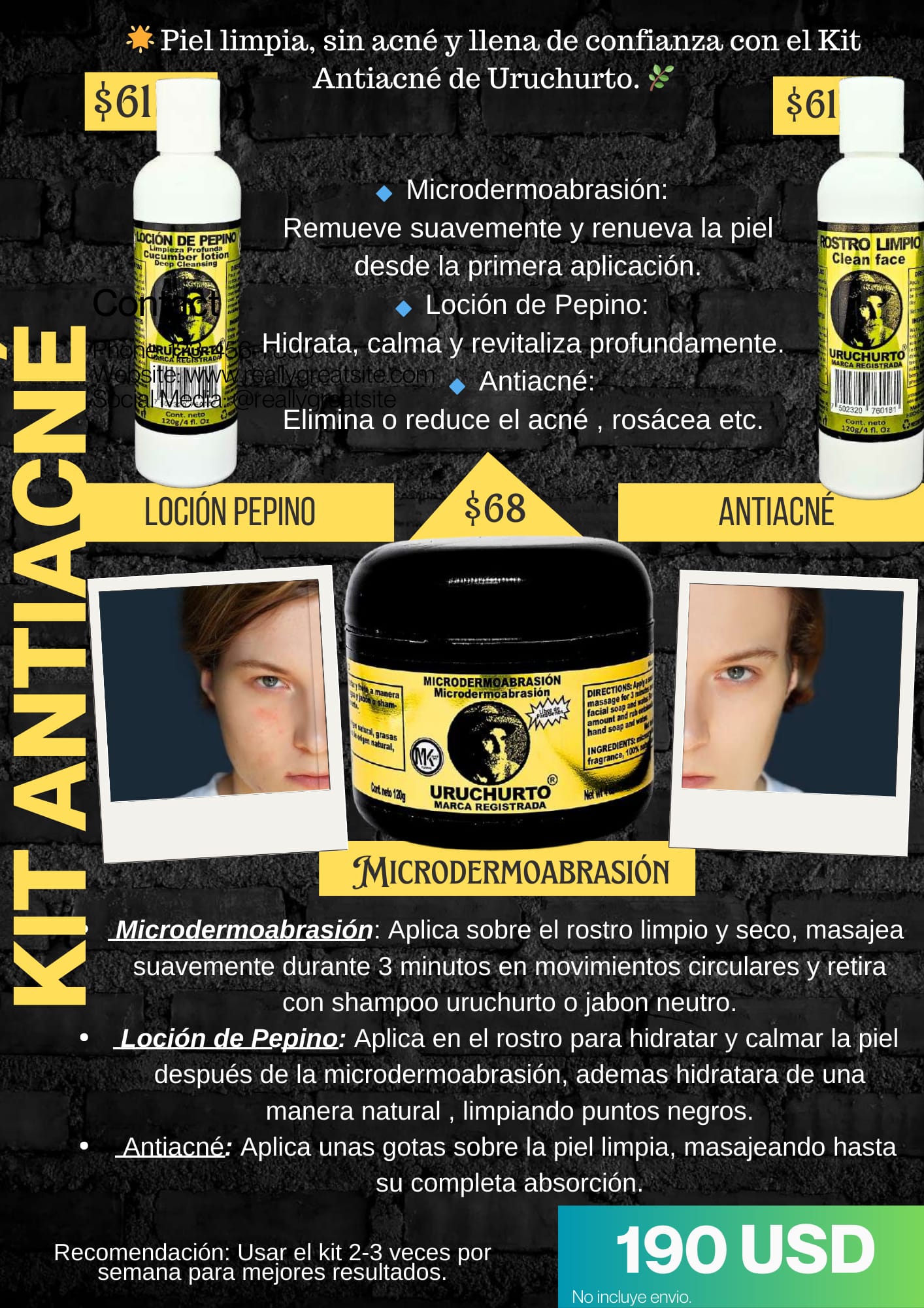KIT ANT_ACNÉ URUCHURTO