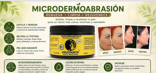 MICRODERMOABRASION URUCHURTO